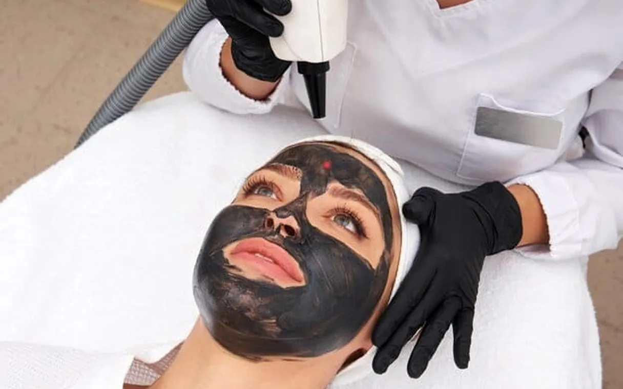 Carbon Laser Peel Before and After: What Six Weeks Really Changes
