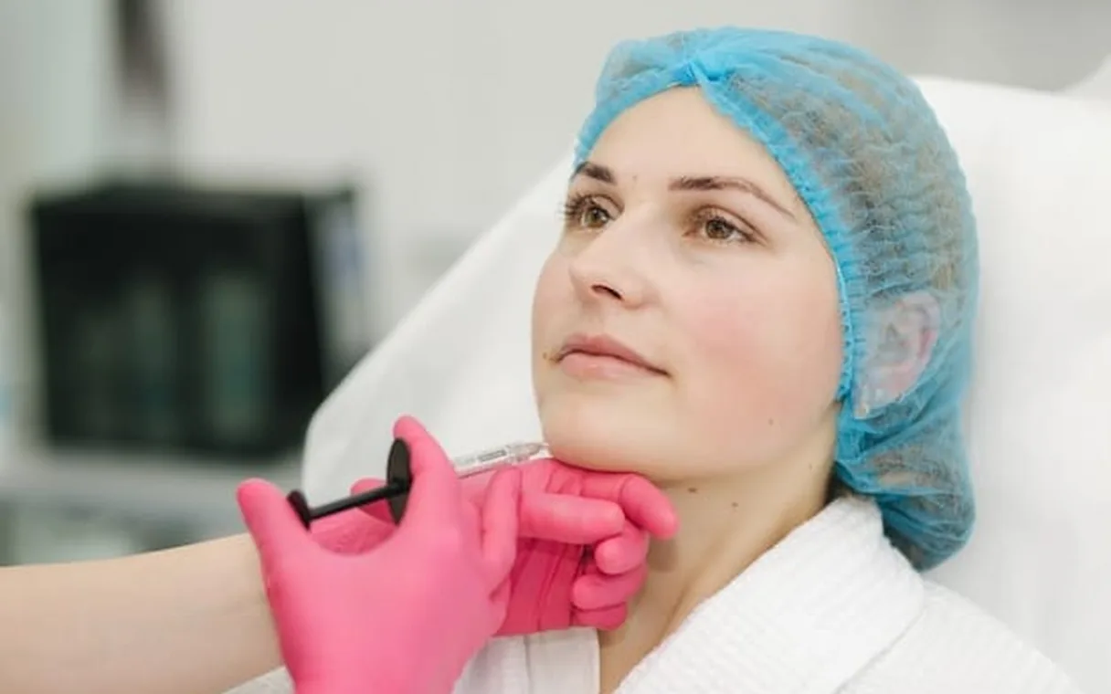 Thread Lift Before and After: 12-Month PDO Results