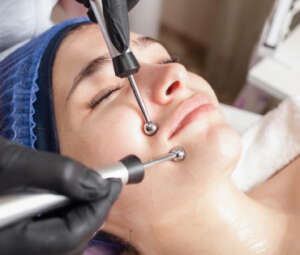 Microdermabrasion Treatment