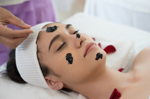 Black Doll Carbon Laser Peel for Acne Scars in Islamabad