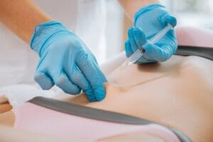 Are Fat Dissolving Injections Safe? Myths and Facts