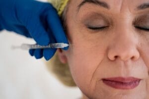 Top Benefits of Face Thread Lift Treatment in Islamabad