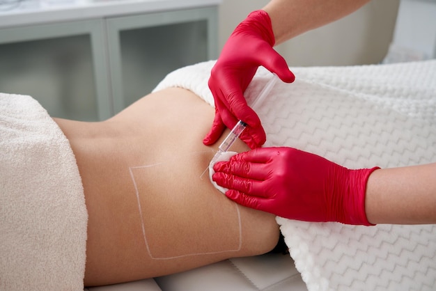 Are Fat Dissolving Injections Safe? Myths and Facts