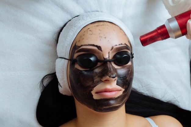 Carbon Laser Peel Cost: Get Glowing Skin at an Affordable Price