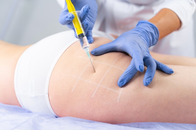 Are Fat Dissolving Injections Safe? Myths and Facts