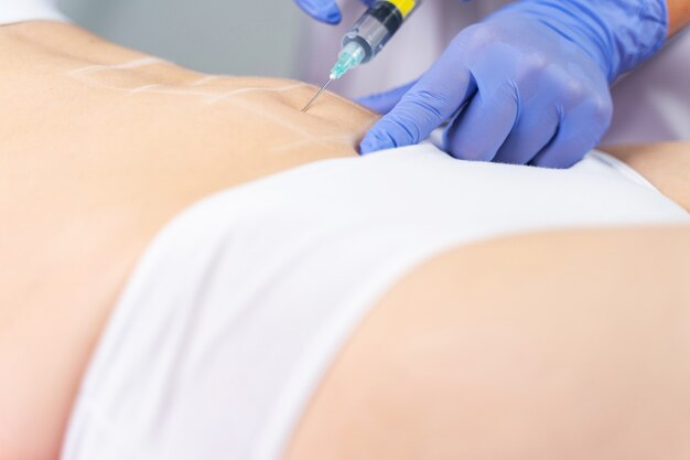 How Long Do Fat Dissolving Injection Results Last?