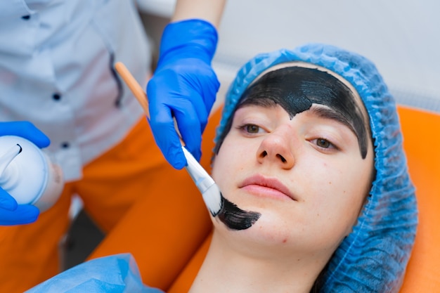 Black Doll Carbon Laser Peel for Acne Scars in Islamabad