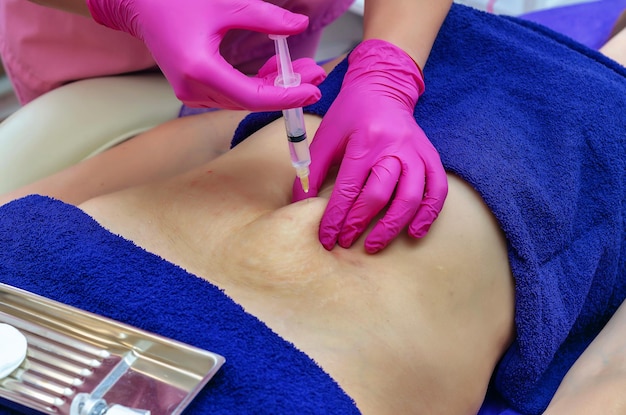 Are Fat Dissolving Injections Safe? Myths and Facts