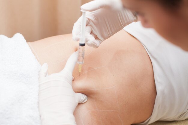 Are Fat Dissolving Injections Safe? Myths and Facts