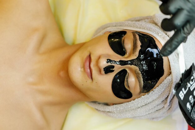 Is Black Doll Carbon Laser Peel Right for Your Skin?