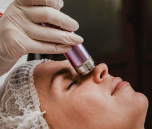 Laser Ablation for Warts, Moles, Milia, and Skin