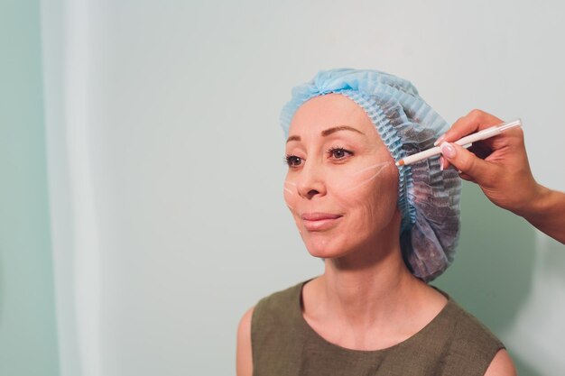 Thread Lift Procedure: What to Expect Step by Step