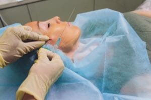 Thread Lift Procedure: What to Expect Step by Step