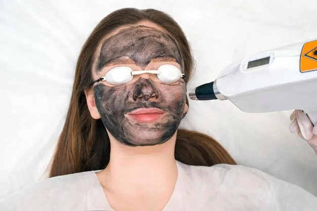 Carbon Laser Peel for Acne Scars: Results and Benefits - Dr Taskeen Iqbal
