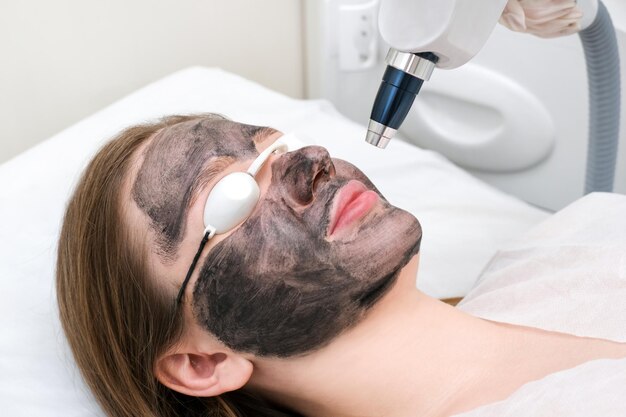 Carbon Laser Peel Price in Pakistan: What to Expect in 2025