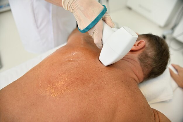 Best Laser Hair Removal for Men's Back: Top Solutions in 2025