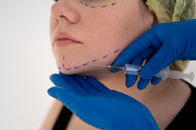 Is Thread Lift Safe? What You Need to Know
