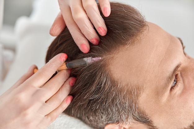 Top Benefits of PRP Hair Treatment in Islamabad