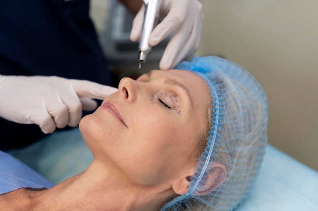 Thread Lift Procedure: What to Expect Step by Step