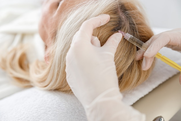 Top Benefits of PRP Hair Treatment in Islamabad