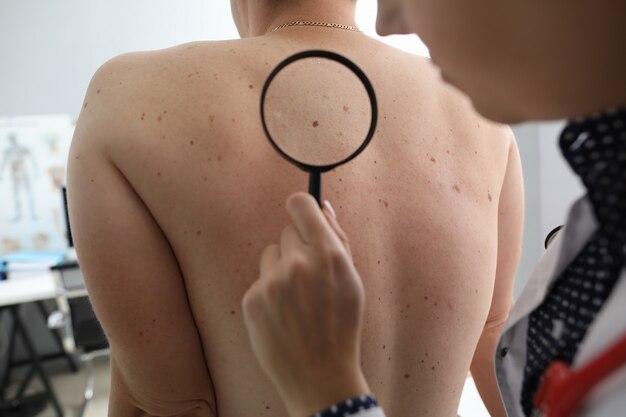 Top Benefits of Laser Ablation for Skin Tags in Islamabad