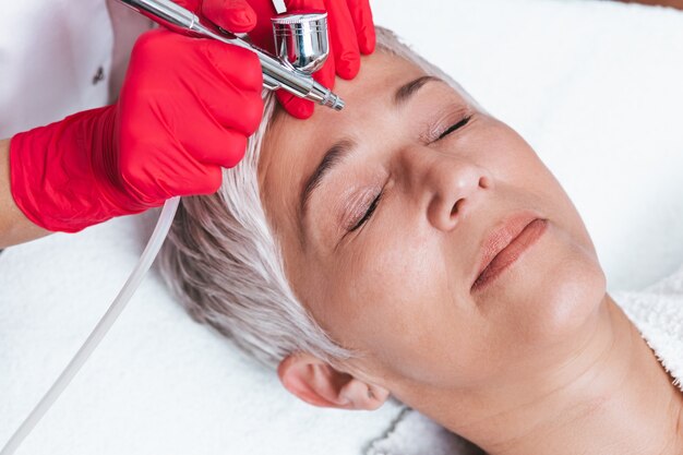 How Microdermabrasion Treatment Works for Glowing Skin