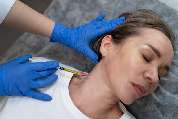 Thread Face Lift: How Long Does It Really Last?