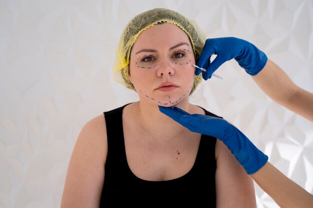 Is Thread Lift Safe? What You Need to Know