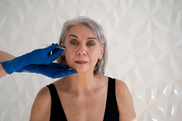 Thread Face Lift: How Long Does It Really Last?