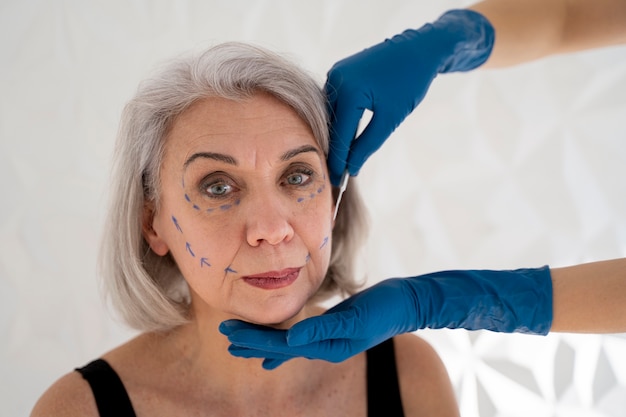 Thread Lift Procedure: What to Expect Step by Step