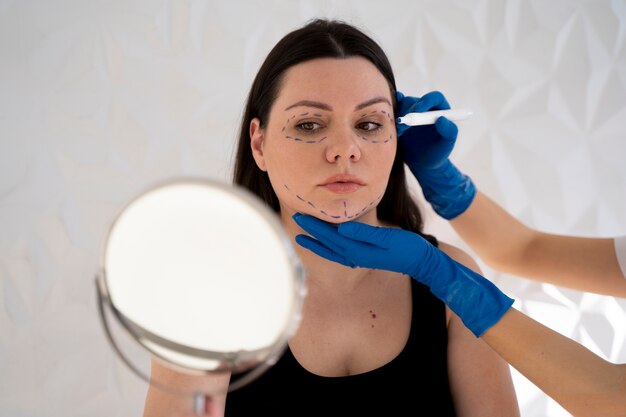 Thread Lift Before and After: See Real Transformations