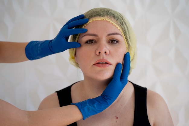 Thread Face Lift: How Long Does It Really Last?