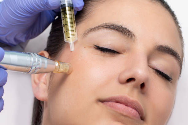 What is Mesotherapy for the Face? Fat Reduction and Skin Benefits