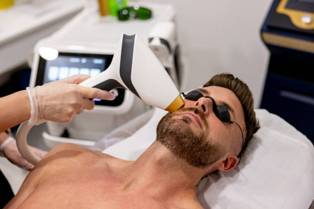 Laser Hair Removal for Men in Islamabad: Benefits & Considerations