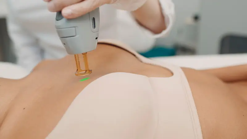 Laser Hair Removal for Breasts: Safety, Benefits & Risks