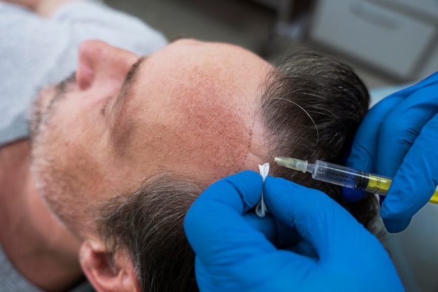5 Myths About PRP Hair Treatment You Should Ignore