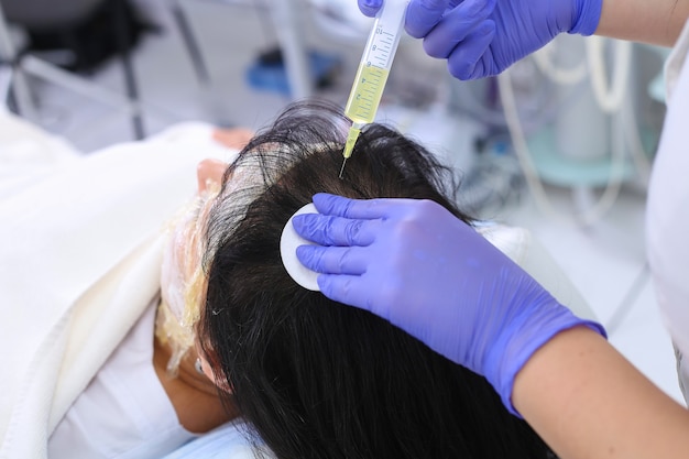 Top Benefits of PRP Hair Treatment in Islamabad