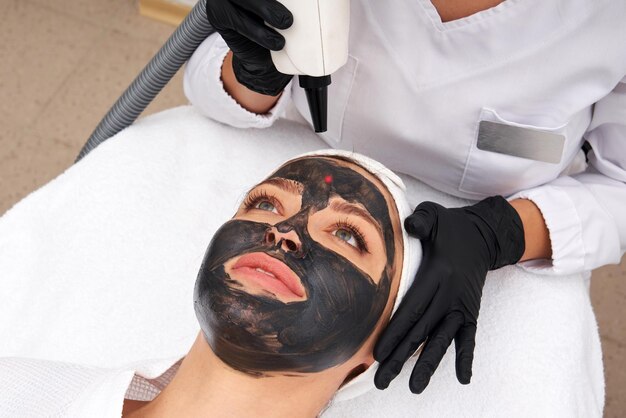 Carbon Laser Peel Before and After: Visible Skin Improvements