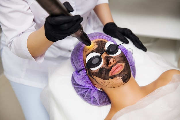 Carbon Laser Peel for Acne Scars: Results and Benefits