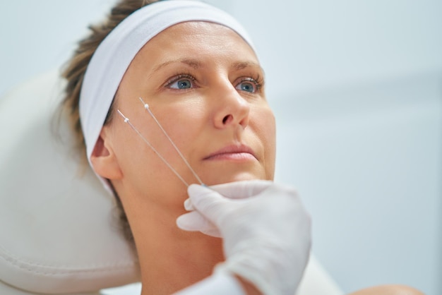 Thread Lift Treatment Explained: Benefits and Results