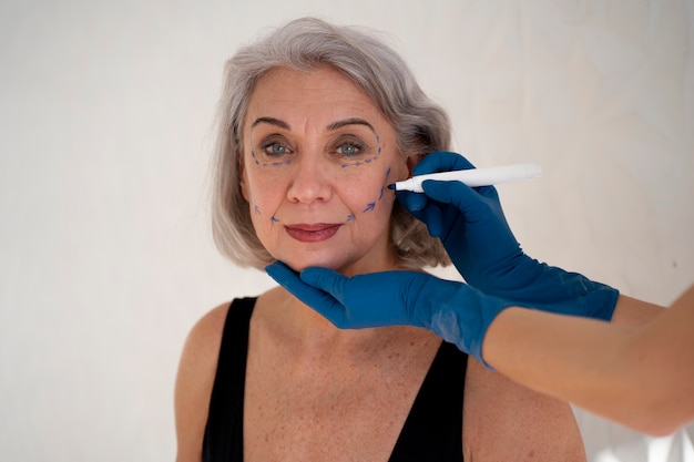 Thread Lift Before and After: See Real Transformations