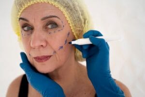 Is Thread Lift Safe? What You Need to Know