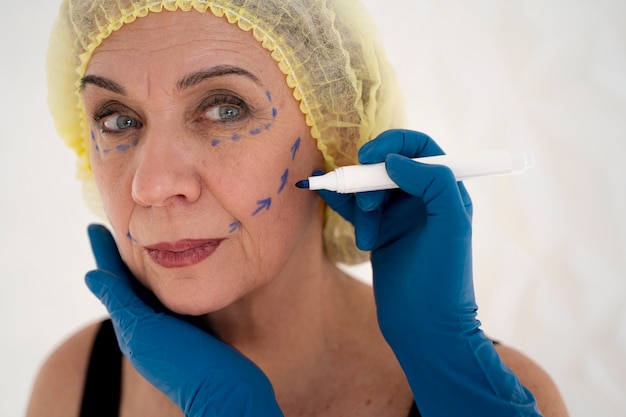 Is Thread Lift Safe? What You Need to Know