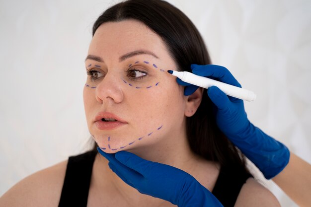 Is Thread Lift Safe? What You Need to Know