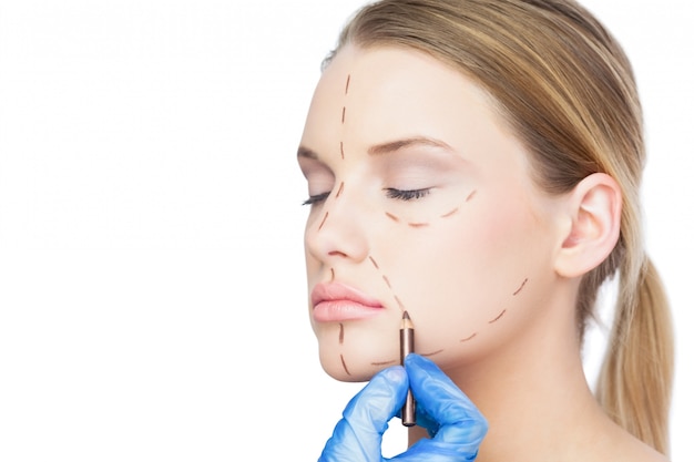 Is Thread Lift Safe? What You Need to Know