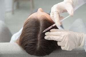 PRP vs Other Hair Loss Treatments: Why Choose PRP?
