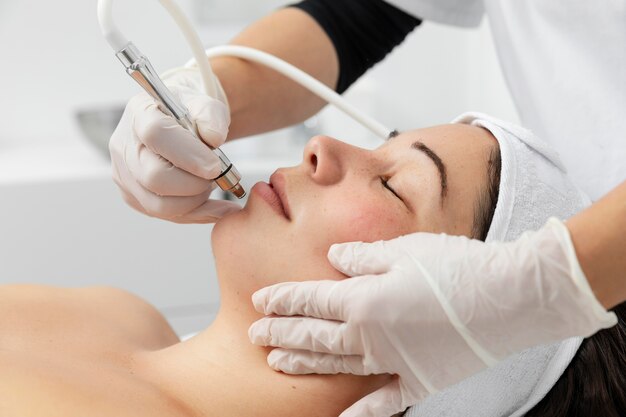 Top Benefits of Microdermabrasion Treatment in Islamabad