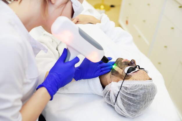 Benefits of Q-Switch Laser Treatment for Skin Rejuvenation