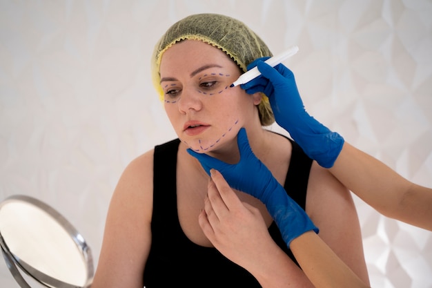 Is Thread Lift Safe? What You Need to Know