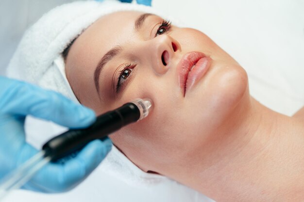 Microdermabrasion Treatment Before and After: Real Results